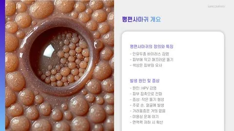 평편사마귀 연고 이미지 6